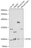 Western blot analysis of extracts of various cell lines, using ACAN antibody (23-644) at 1:1000 dilution.<br/>Secondary antibody: HRP Goat Anti-Rabbit IgG (H+L) at 1:10000 dilution.<br/>Lysates/proteins: 25ug per lane.<br/>Blocking buffer: 3% nonfat dry milk in TBST.<br/>Detection: ECL Basic Kit.<br/>Exposure time: 90s.