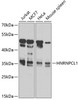 Western blot analysis of extracts of various cell lines, using HNRNPCL1 Antibody (23-686) at 1:1000 dilution.<br/>Secondary antibody: HRP Goat Anti-Rabbit IgG (H+L) at 1:10000 dilution.<br/>Lysates/proteins: 25ug per lane.<br/>Blocking buffer: 3% nonfat dry milk in TBST.<br/>Detection: ECL Basic Kit.<br/>Exposure time: 90s.