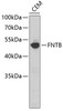 Western blot analysis of extracts of CEM cells, using FNTB antibody (23-706) .<br/>Secondary antibody: HRP Goat Anti-Rabbit IgG (H+L) at 1:10000 dilution.<br/>Lysates/proteins: 25ug per lane.<br/>Blocking buffer: 3% nonfat dry milk in TBST.