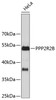 Western blot analysis of extracts of HeLa cells, using PPP2R2B antibody (23-751) .<br/>Secondary antibody: HRP Goat Anti-Rabbit IgG (H+L) at 1:10000 dilution.<br/>Lysates/proteins: 25ug per lane.<br/>Blocking buffer: 3% nonfat dry milk in TBST.