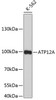 Western blot analysis of extracts of K-562 cells, using ATP12A antibody (23-754) .<br/>Secondary antibody: HRP Goat Anti-Rabbit IgG (H+L) at 1:10000 dilution.<br/>Lysates/proteins: 25ug per lane.<br/>Blocking buffer: 3% nonfat dry milk in TBST.