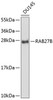 Western blot analysis of extracts of DU145 cells, using RAB27B antibody (23-755) .<br/>Secondary antibody: HRP Goat Anti-Mouse IgG (H+L) (AS003) at 1:10000 dilution.<br/>Lysates/proteins: 25ug per lane.<br/>Blocking buffer: 3% nonfat dry milk in TBST.