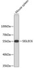 Western blot analysis of extracts of mouse spleen, using SIGLEC6 antibody (23-756) .<br/>Secondary antibody: HRP Goat Anti-Rabbit IgG (H+L) at 1:10000 dilution.<br/>Lysates/proteins: 25ug per lane.<br/>Blocking buffer: 3% nonfat dry milk in TBST.