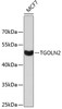 Western blot analysis of extracts of MCF-7 cells, using TGOLN2 antibody (23-760) .<br/>Secondary antibody: HRP Goat Anti-Rabbit IgG (H+L) at 1:10000 dilution.<br/>Lysates/proteins: 25ug per lane.<br/>Blocking buffer: 3% nonfat dry milk in TBST.