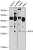 Western blot analysis of extracts of various cell lines, using KLK8 antibody (23-767) at 1:1000 dilution.<br/>Secondary antibody: HRP Goat Anti-Rabbit IgG (H+L) at 1:10000 dilution.<br/>Lysates/proteins: 25ug per lane.<br/>Blocking buffer: 3% nonfat dry milk in TBST.<br/>Detection: ECL Basic Kit.<br/>Exposure time: 20s.