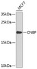 Western blot analysis of extracts of MCF-7 cells, using CNBP antibody (23-777) .<br/>Secondary antibody: HRP Goat Anti-Rabbit IgG (H+L) at 1:10000 dilution.<br/>Lysates/proteins: 25ug per lane.<br/>Blocking buffer: 3% nonfat dry milk in TBST.