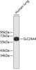 Western blot analysis of extracts of human lung, using SLC24A4 antibody (23-848) .<br/>Secondary antibody: HRP Goat Anti-Rabbit IgG (H+L) at 1:10000 dilution.<br/>Lysates/proteins: 25ug per lane.<br/>Blocking buffer: 3% nonfat dry milk in TBST.