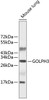 Western blot analysis of extracts of mouse lung, using GOLPH3 antibody (23-850) .<br/>Secondary antibody: HRP Goat Anti-Rabbit IgG (H+L) at 1:10000 dilution.<br/>Lysates/proteins: 25ug per lane.<br/>Blocking buffer: 3% nonfat dry milk in TBST.
