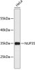 Western blot analysis of extracts of HeLa cells, using NUP35 antibody (23-852) .<br/>Secondary antibody: HRP Goat Anti-Rabbit IgG (H+L) at 1:10000 dilution.<br/>Lysates/proteins: 25ug per lane.<br/>Blocking buffer: 3% nonfat dry milk in TBST.