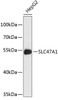Western blot analysis of extracts of HepG2 cells, using SLC47A1 antibody (23-860) .<br/>Secondary antibody: HRP Goat Anti-Rabbit IgG (H+L) at 1:10000 dilution.<br/>Lysates/proteins: 25ug per lane.<br/>Blocking buffer: 3% nonfat dry milk in TBST.