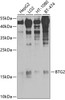 Western blot analysis of extracts of various cell lines, using BTG2 antibody (23-940) at 1:1000 dilution.<br/>Secondary antibody: HRP Goat Anti-Rabbit IgG (H+L) at 1:10000 dilution.<br/>Lysates/proteins: 25ug per lane.<br/>Blocking buffer: 3% nonfat dry milk in TBST.<br/>Detection: ECL Basic Kit.<br/>Exposure time: 90s.
