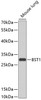 Western blot analysis of extracts of mouse lung, using BST1 antibody (23-965) at 1:1000 dilution.<br/>Secondary antibody: HRP Goat Anti-Rabbit IgG (H+L) at 1:10000 dilution.<br/>Lysates/proteins: 25ug per lane.<br/>Blocking buffer: 3% nonfat dry milk in TBST.<br/>Detection: ECL Basic Kit.<br/>Exposure time: 90s.