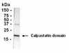 Western Blot detection of CAST antibody.