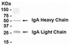 Human plasma protein as test antigen. Affinity-purified IgY dilution: 1:500, Goat anti-IgY-HRP dilution: 1:1000. Colorimetric method for signal development.