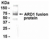 E coli-derived fusion protein as test antigen. Affinity-purified IgY dilution: 1:2000, Goat anti-IgY-HRP dilution: 1:1000. Colorimetric method for signal development.