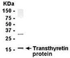 Human plasma protein as test antigen. Affi-pure IgY as primary antibody and Goat-anti-IgY-HRP as 2nd antibody. Fixed amount of Ab (1 ug/mL) and serial dilutions of Ag. E coli-derived fusion protein as test antigen. Affinity-purified IgY dilution: 1:2000, Goat anti-IgY-HRP dilution: 1:1000. Colorimetric method for signal development.