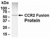 E coli-derived fusion protein as test antigen. Affinity-purified IgY dilution: 1:1000, Goat anti-IgY-HRP dilution: 1:1000. Colorimetric method for signal development.