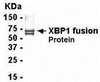 E coli-derived fusion protein as test antigen. Affinity-purified IgY dilution: 1:2000, Goat anti-IgY-HRP dilution: 1:1000. Colorimetric method for signal development.