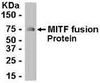 E coli-derived fusion protein as test antigen. Affinity-purified IgY dilution: 1:2000, Goat anti-IgY-HRP dilution: 1:1000. Colorimetric method for signal development.