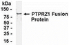 E coli-derived fusion protein as test antigen. Affinity-purified IgY dilution: 1:2000, Goat anti-IgY-HRP dilution: 1:1000. Colorimetric method for signal development.