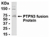 E coli-derived fusion protein as test antigen. Affinity-purified IgY dilution: 1:2000, Goat anti-IgY-HRP dilution: 1:1000. Colorimetric method for signal development.