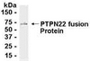 E coli-derived fusion protein as test antigen. Affinity-purified IgY dilution: 1:2000, Goat anti-IgY-HRP dilution: 1:1000. Colorimetric method for signal development.