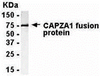 E coli-derived fusion protein as test antigen. anti-CAPZA1 IgY dilution: 1:2000, Goat anti-IgY-HRP dilution: 1:1000. Colorimetric method for signal development.