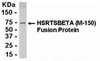 E coli-derived fusion protein as test antigen. Affinity-purified IgY dilution: 1:2000, Goat anti-IgY-HRP dilution: 1:1000. Colorimetric method for signal development.