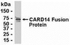 E coli-derived fusion protein as test antigen. Affinity-purified IgY dilution: 1:2000, Goat anti-IgY-HRP dilution: 1:1000. Colorimetric method for signal development.