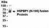 E coli-derived fusion protein as test antigen. Affinity-purified IgY dilution: 1:2000, Goat anti-IgY-HRP dilution: 1:1000. Colorimetric method for signal development.