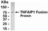 Direct Elisa Test. Protein as test antigen. Affi-pure IgY as primary antibody and Goat anti-IgY HRP as 2nd antibody. Fixed amount of antibody (1 ug/mL) and serial dilutions of antigen. <br><br>E coli-derived fusion protein as test antigen. Affinity-purified IgY dilution: 1:2000, Goat anti-IgY-HRP dilution: 1:1000. Colorimetric method for signal development.