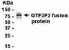 E coli-derived fusion protein as test antigen. Affinity-purified IgY dilution: 1:2000, Goat anti-IgY-HRP dilution: 1:1000. Colorimetric method for signal development.