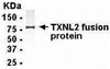 E coli-derived fusion protein as test antigen. Affinity-purified IgY dilution: 1:2000, Goat anti-IgY-HRP dilution: 1:1000. Colorimetric method for signal development.