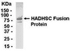 E coli-derived fusion protein as test antigen. Affinity-purified IgY dilution: 1:2000, Goat anti-IgY-HRP dilution: 1:1000. Colorimetric method for signal development.