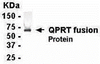 E coli-derived fusion protein as test antigen. Affinity-purified IgY dilution: 1:2000, Goat anti-IgY-HRP dilution: 1:1000. Colorimetric method for signal development.