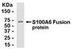 E coli-derived fusion protein as test antigen. Affinity-purified IgY dilution: 1:2000, Goat anti-IgY-HRP dilution: 1:1000. Colorimetric method for signal development.