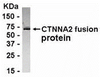 E coli-derived fusion protein as test antigen. Affinity-purified IgY dilution: 1:2000, Goat anti-IgY-HRP dilution: 1:1000. Colorimetric method for signal development.