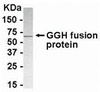 E coli-derived fusion protein as test antigen. Affinity-purified IgY dilution: 1:2000, Goat anti-IgY-HRP dilution: 1:1000. Colorimetric method for signal development.