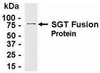 E coli-derived fusion protein as test antigen. Affinity-purified IgY dilution: 1:2000, Goat anti-IgY-HRP dilution: 1:1000. Colorimetric method for signal development.