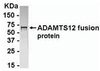 E coli-derived fusion protein as test antigen. Affinity-purified IgY dilution: 1:2000, Goat anti-IgY-HRP dilution: 1:1000. Colorimetric method for signal development.