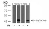 Western blot analysis of lysed extracts from HepG2 and HeLa cells untreated or treated with UV using MEK-2 (Phospho-Thr394) .