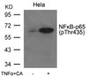 Western blot analysis of lysed extracts from HeLa cells untreated or treated with TNF&#945;+CA using NF&#954;B-p65 (Phospho-Thr435) .