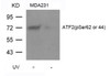 Western blot analysis of lysed extracts from MDA231 cells untreated or treated with UV using ATF2 (Phospho-Ser62 or 44) .