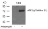 Western blot analysis of lysed extracts from 3T3 cells untreated or treated with Anisomycin using ATF2 (Phospho-Thr69 or 51) .