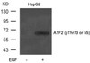 Western blot analysis of lysed extracts from HepG2 cells untreated or treated with EGF using ATF2 (Phospho-Thr71 or 53) .