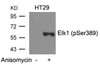 Western blot analysis of lysed extracts from HT29 cells untreated or treated with Anisomycin using Elk1 (Phospho-Ser389) .