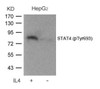 Western blot analysis of lysed extracts from HepG2 cells untreated or treated with IL-4 using STAT4 (Phospho-Tyr693) .