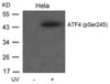 Western blot analysis of lysed extracts from HeLa cells untreated or treated with UV using ATF4 (Phospho-Ser245) .