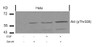 Western blot analysis of lysed extracts from HeLa cells untreated or treated with EGF, serum or both using Akt (Phospho-Thr308) .