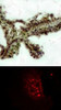 <b>Top Image:</b> Immunohistochemical analysis of paraffin-embedded human lung carcinoma tissue, using Akt (Phospho-Thr308) .<b>Bottom Image:</b> Immunofluorescence staining of methanol-fixed HeLa cells showing nuclear dot staining using Akt (Phospho-Thr308) .